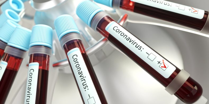 coronavirus au pérou - y a t-il un risque à faire votre voyage?