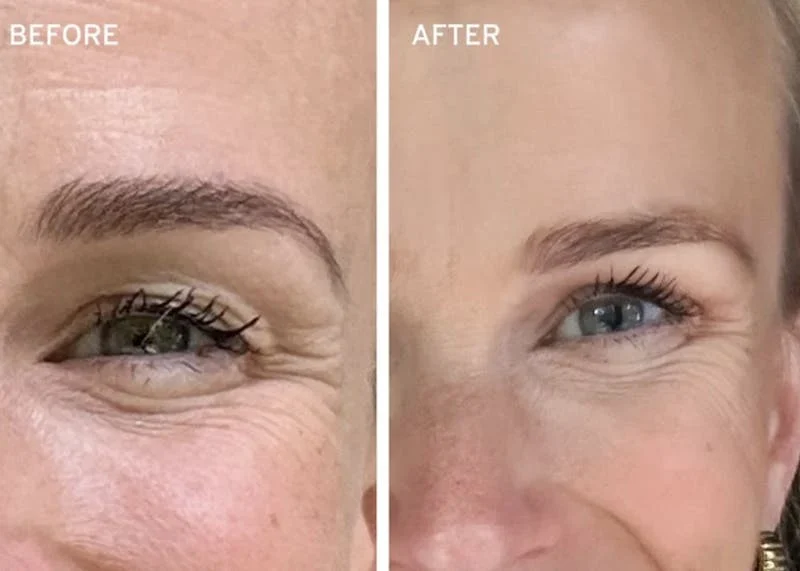 Woman showing eyes before and after using Oliveda products